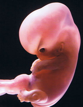 Зародыш 6 Недель Фото